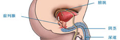 前列腺增生久治不愈，让我很'难'